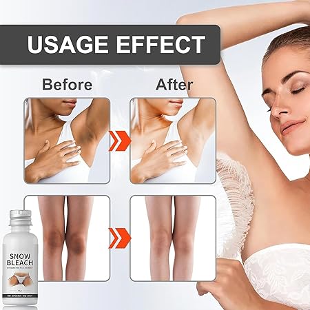 ✨ Snow Bleach كريم ✨